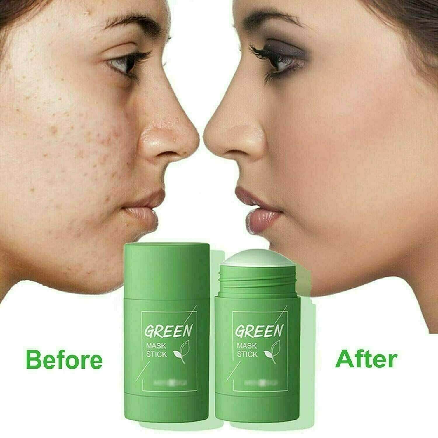 Green Tea Deep Cleanse Mask - 🔥Fast Shipping (1-3 Days) 🚀